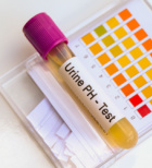 תוסף סלניום - תמונת אווירה